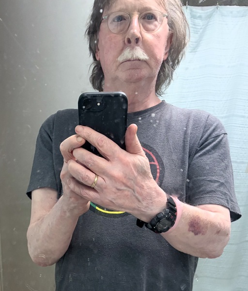 Adam2